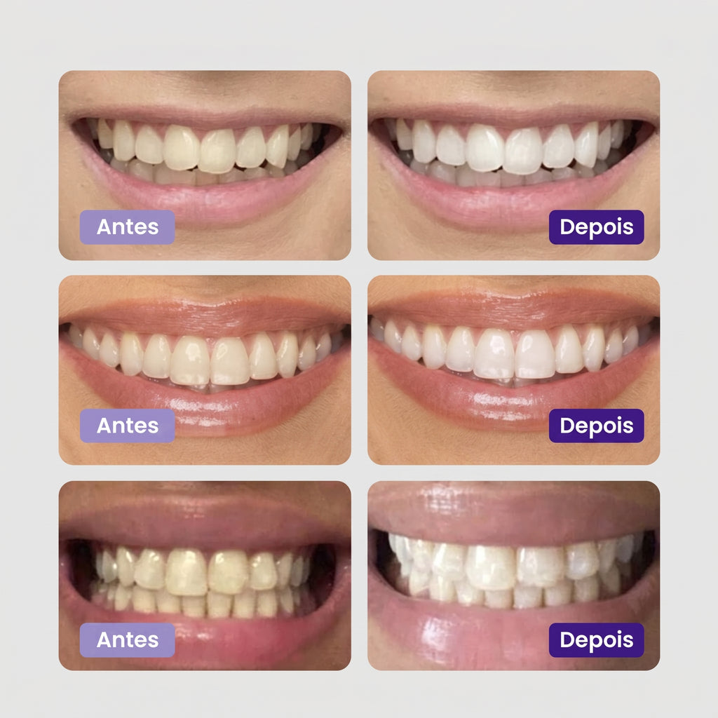 Clareador Dentário - Sérum V34™ + Brinde